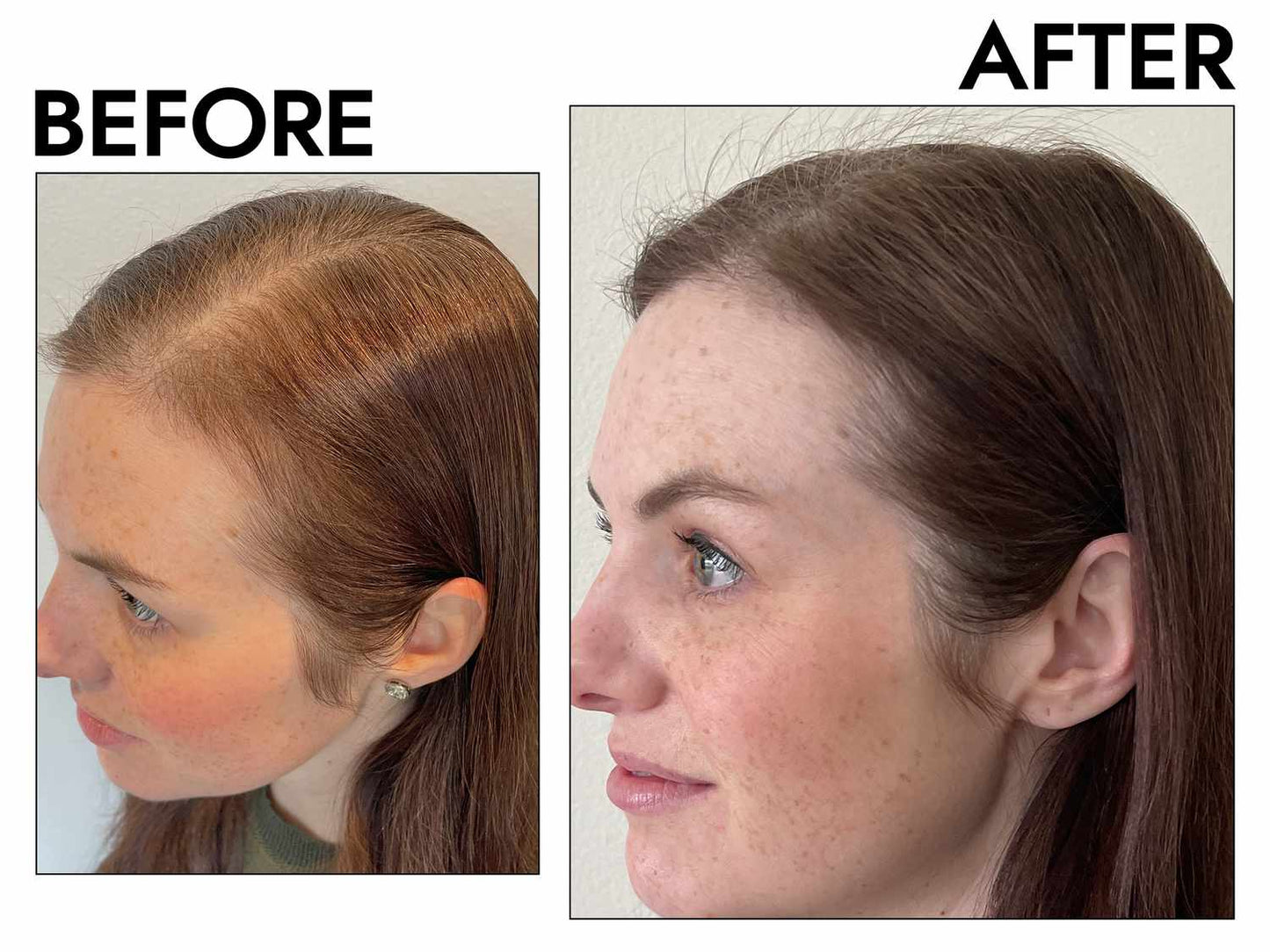 Anti-Hair Loss &amp; Hair Growth Shampoo